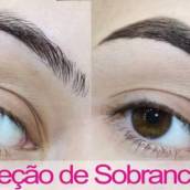 Correção de Sobrancelha 