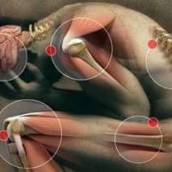 Terapia Miofascial
