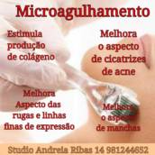 Migroagulhamento