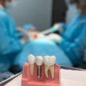Implante Dentário