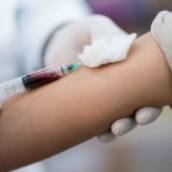 Exame de sangue