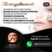 Microagulhamento 