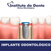 Implante 
