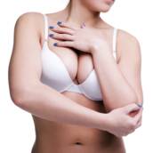 Mamoplastia