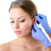 Otoplastia