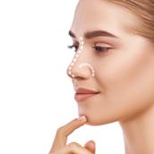  Rinoplastia