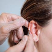 Auricoloterapia