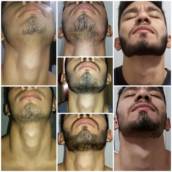 Barba
