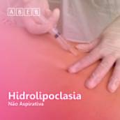Hidrolipoclasia Não Aspirativa