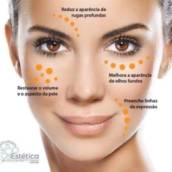Preenchimento Labial