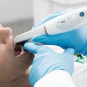 Escaneamento IntraOral