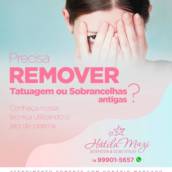 Remoção de Tatuagem e Sobrancelhas Antigas