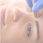 Peeling de Diamante