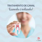Endodontia - Tratamento de canal