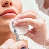 Estética facial