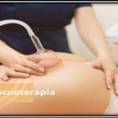  Vacuoterapia