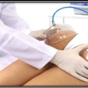  VACUOTERAPIA  PAMP UP- “BUMBUM NA NUCA”