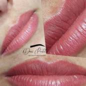 Revitalização Labial