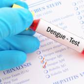 Exame Dengue