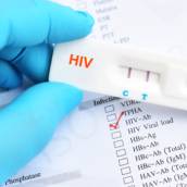 Teste de HIV - AIDS