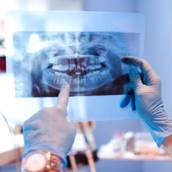 Radiografia Panorâmica