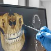 Prototipagem de Tomografia