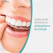 Invisalign