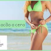 Depilação Feminina