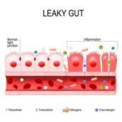 Teste de Intolerância alimentar mediada por IgG