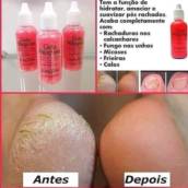 Gota Milagrosa em Bauru