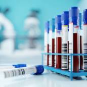 Exames Toxicológicos - Geral