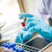 Exames Toxicológicos - Mulher 