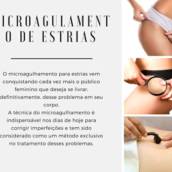 Microagulhamento de Estrias 