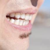 Tratamento de DTM (Bruxismo)