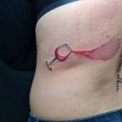 Cobertura de Cicatriz com Tatuagem