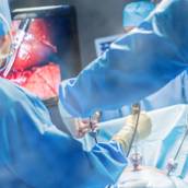 CIRURGIA DE GLAUCOMA