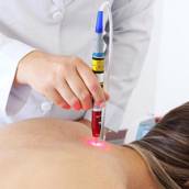 Acupuntura a laser