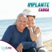 Implante dentário - Agende sua avaliação