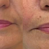 Preenchimento de Bigode chinês