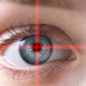 CIRURGIA REFRATIVA (CIRURGIA PARA CORREÇÃO DO GRAU)