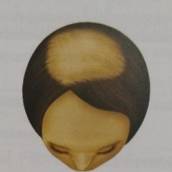 Tratamento para Alopecia Feminina