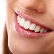 Estética Dentária (Lentes de Contato e Facetas)