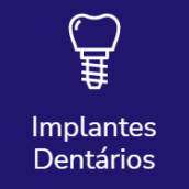 Implantes Dentários