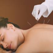 Tratamento com Acupuntura em São Manuel/SP