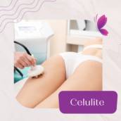 Celulite