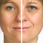 Produtos para Rejuvenescimento Facial