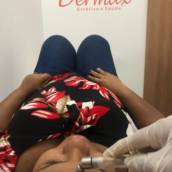 Peeling de diamante