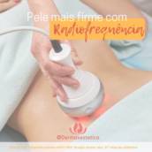 Radiofrequência