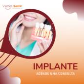 Implante dentário