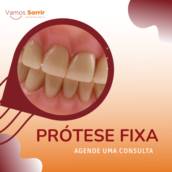 Prótese fixa